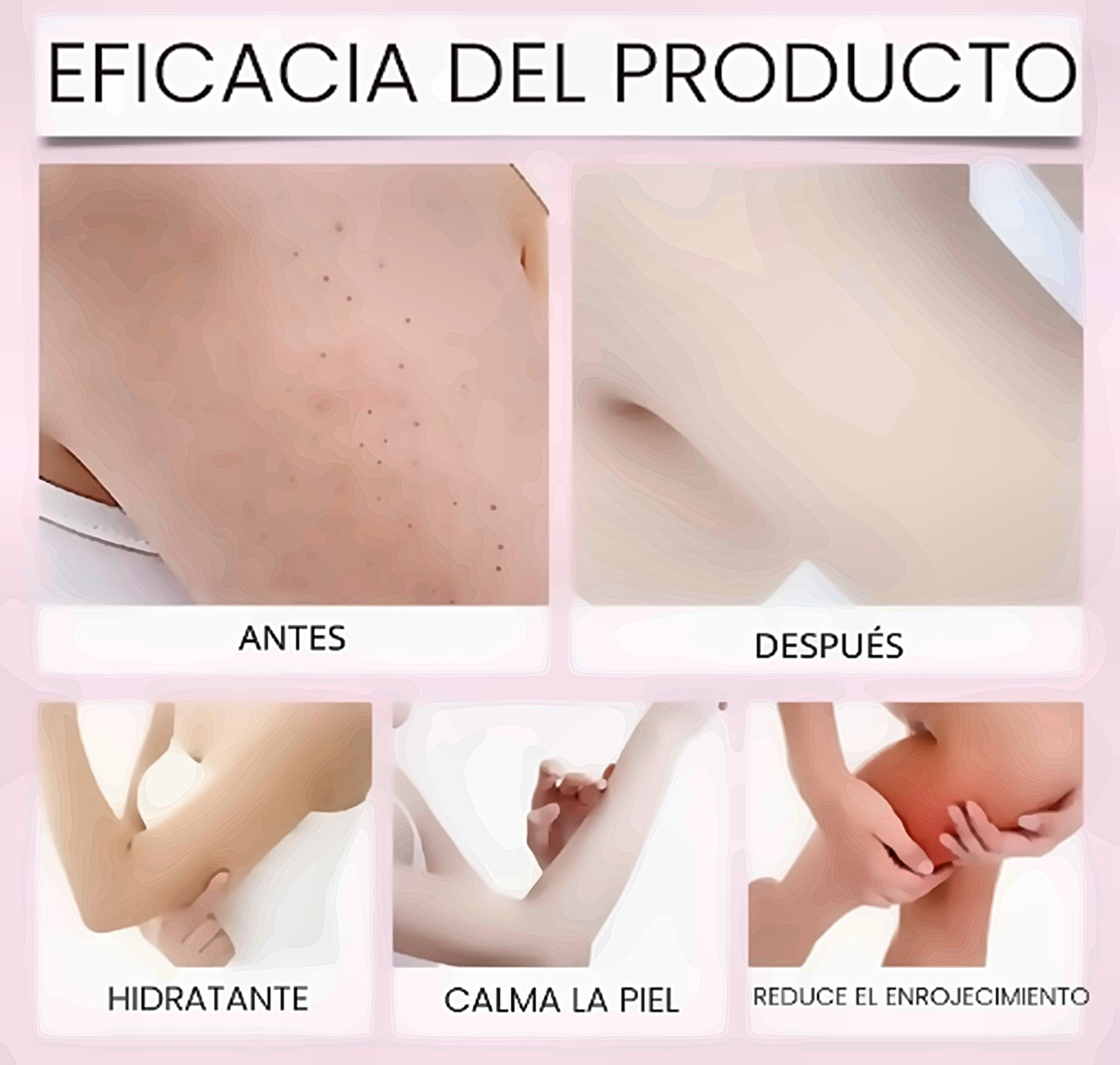 Aceite Natural Post-Depilación